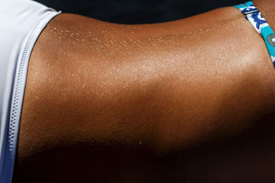 Tu solarium en Vigo y Pontevedra para lucir un bronceado envidiable